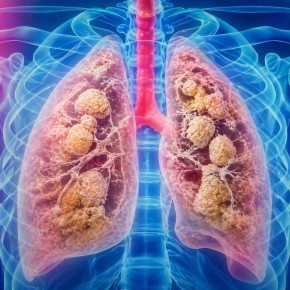 ������������ �������� �������� ����������� ������