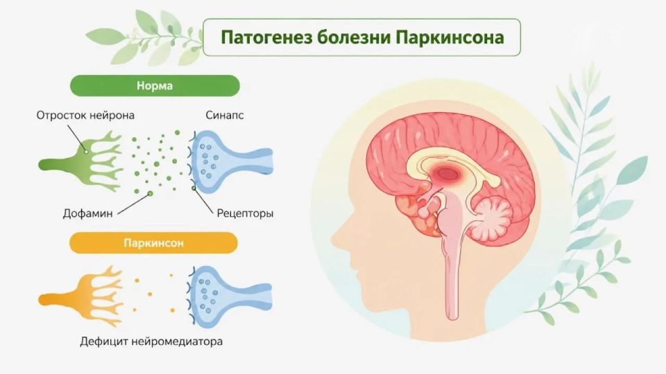На втором месте после Альцгеймера На втором месте после Альцгеймера