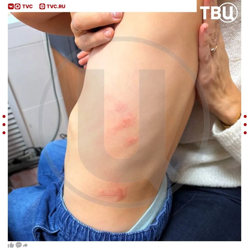 Дети получили травмы в детском саду Томска из-за падения шкафа Дети получили травмы в детском саду Томска из-за падения шкафа